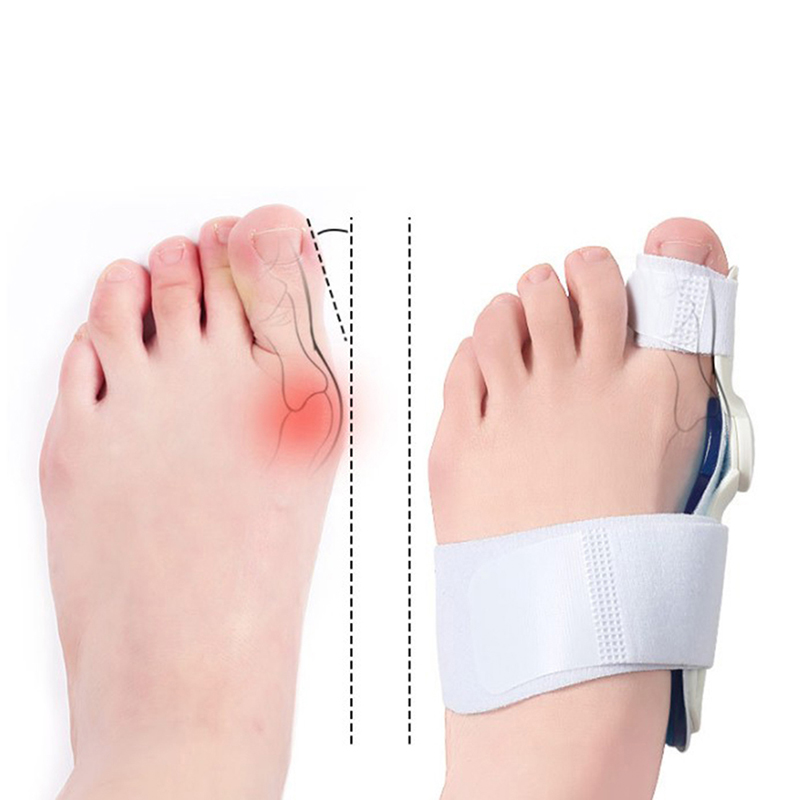 Gel Bunion Splint Big Toe Straightener Corrector Foot Pain Relief Hallux Valgus Eur